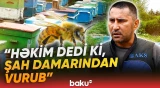Tərtərdə 48 yaşlı kişi arı sancması nəticəsində dünyasını dəyişdi - Baku TV