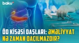 Öd kisəsində daşlar niyə yaranır? - Əsas əlamətlər və səbəblər | BAKU MED