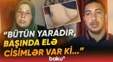 "Balama 50 qəpiklik dondurma ala bilmirəm" - Hərbi xidmətdə yaralanan ata niyə çarəsizdir? - Baku TV