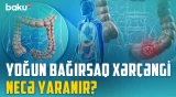 Bütün poliplər təhlükəlidir? - Yoğun bağırsaq xərçənginin qarşısını necə almaq olar? | BAKU MED