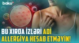 Qısa təmasla yoluxma riski: Ev heyvanınız fərqinə varmadan infeksiya mənbəyinə çevrilə bilər?