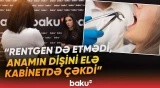 “Həkim bilirdi ki...” | Dişini çəkdirən qadın xərçəng oldu | Bakıda dəhşət - Baku TV