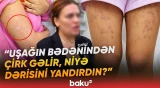 “Uşaq ağlaya-ağlaya çıxıb” | “Mika lazer” salonunda nə baş verib? | “Bədəni bütün yaradır” - Baku TV