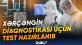 Belə analiz xəstəliyin əlamətlərini daha tez aşkar edə bilir