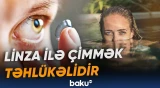 Linzadan istifadə edənlərə oftalmoloqdan xəbərdarlıq