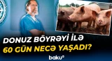 Tibb dünyasını təəccübləndirən hadisə | Donuz böyrəyi ilə yaşayan qadın...