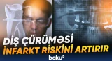 Mütəxəssislər çürük dişlərin yaratdığı ciddi təhlükə barədə xəbərdarlıq etdi