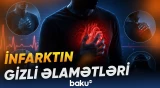 Sinə ağrısından başqa hansı əlamətlər infarkta işarə edə bilər?