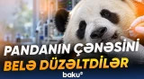 Əyri çənə düzəldildikdən sonra Bəsiyanın qidalanma problemi də aradan qalxıb