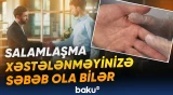 Adi bir salamlaşma hansı xəstəliklərə yol açır?