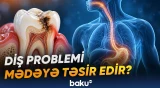 Ağız sağlamlığındakı pozuntular orqanizmə müxtəlif təsirlər göstərə bilər