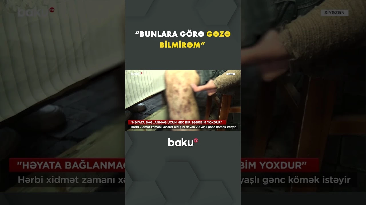 Bir partlayış 20 yaşlı gəncin həyatını dəyişdi - Baku TV