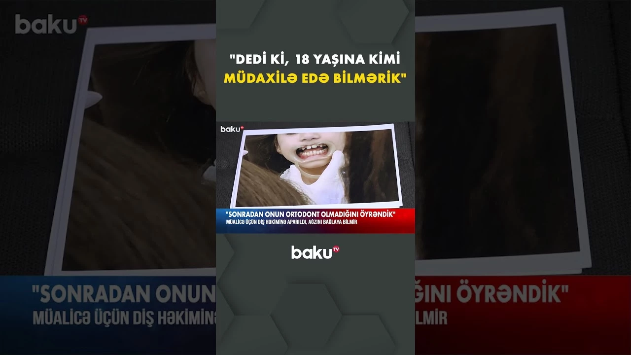 Müalicə üçün qızını diş həkiminə aparan valideyn peşman oldu - Baku TV