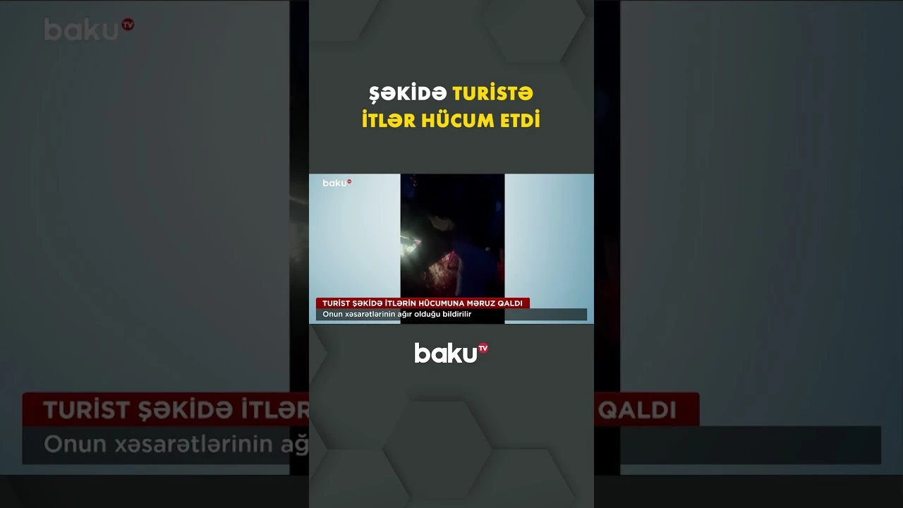 Şəkidə Niderland vətəndaşını itlər ağır yaraladı - Baku TV