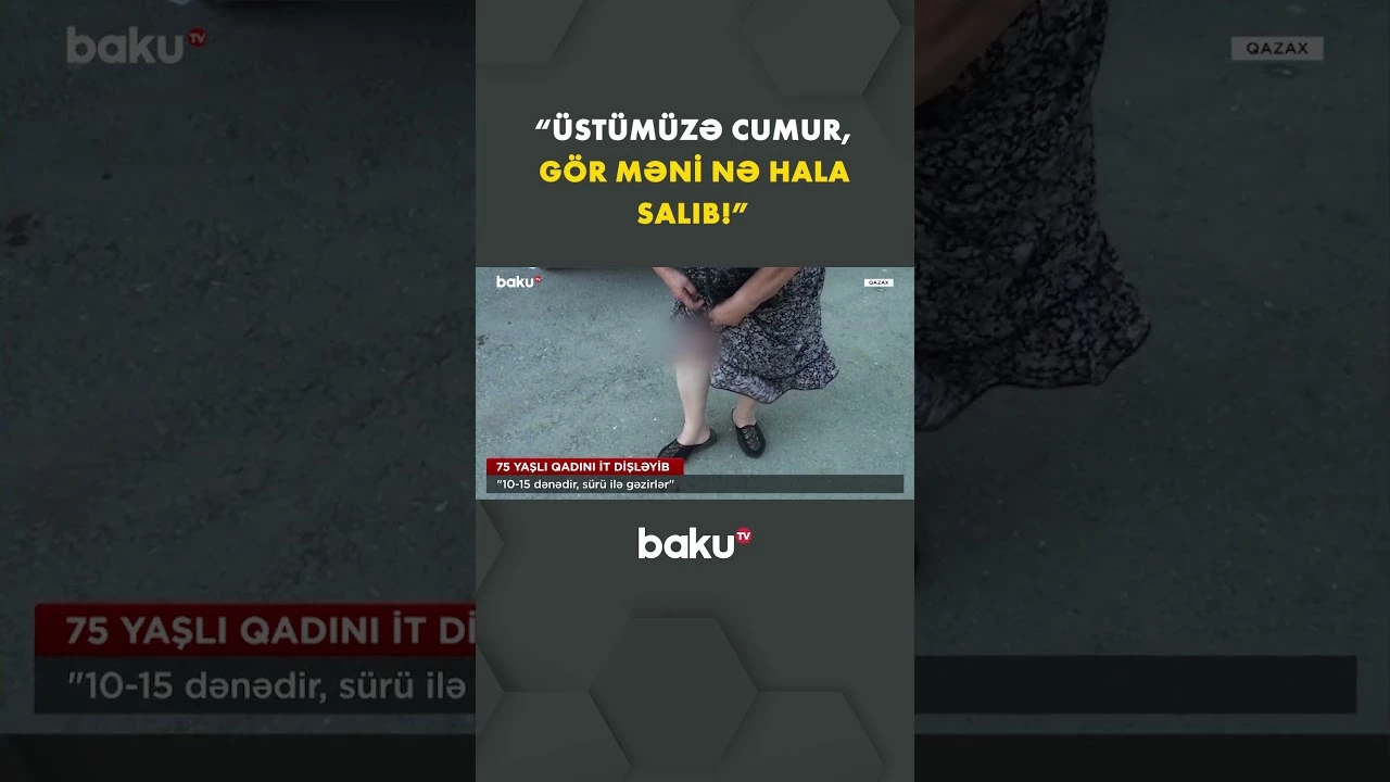 “Üstümüzə cumur, gör məni nə hala salıb!” - Baku TV