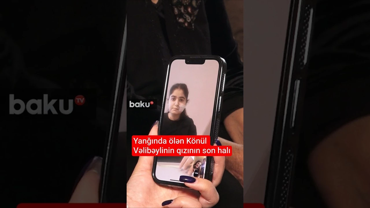 Yanğında ölən Könül Vəlibəylinin qızının son halı