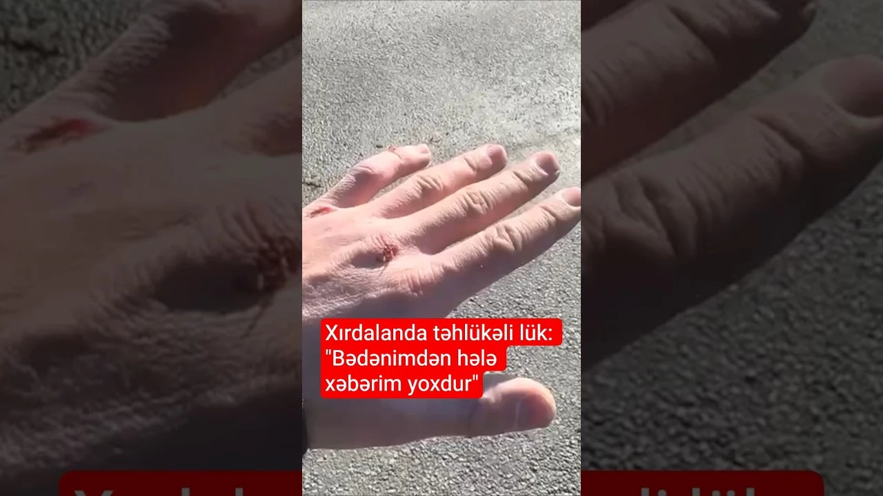 Xırdalanda kanalizasiya lükü qəzaya səbəb oldu - Baku TV